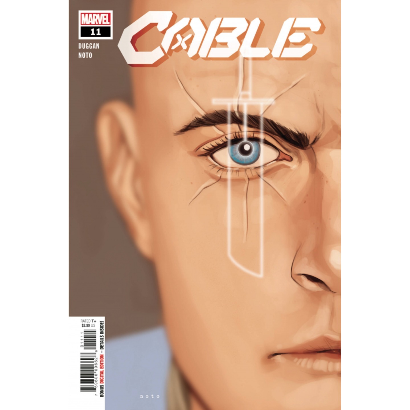 CABLE #11