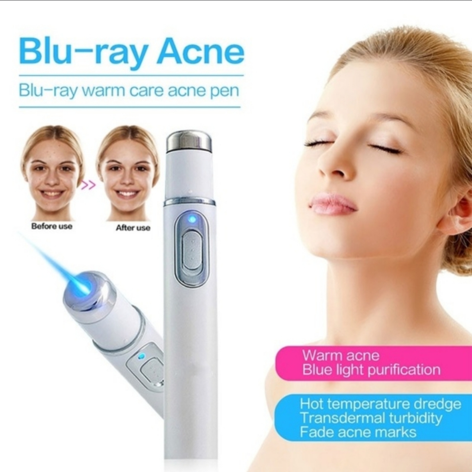 Blu Ray Acne, Freckle, Mole, Dark Spot Removal Pen Skin 