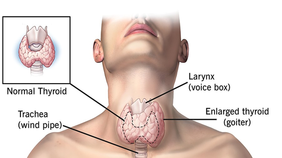 Thyroid Image.jpg