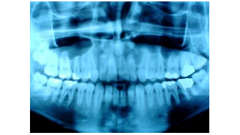 Dental-X-rays.jpg