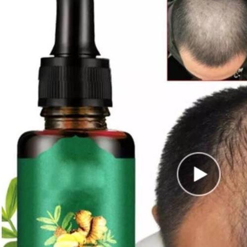 Anti Hair Loss Essence with Ginger Natural Extract with Hair Repair and Hair Strengthening Properties