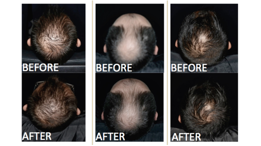 Scalp Pictures before and after.jpg