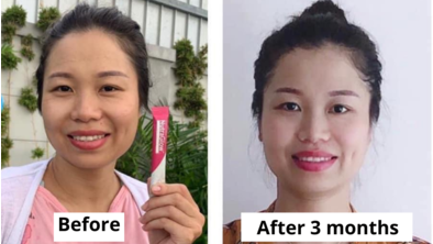 Significant improvements in wrinkles and solve skin problems copy 2.png