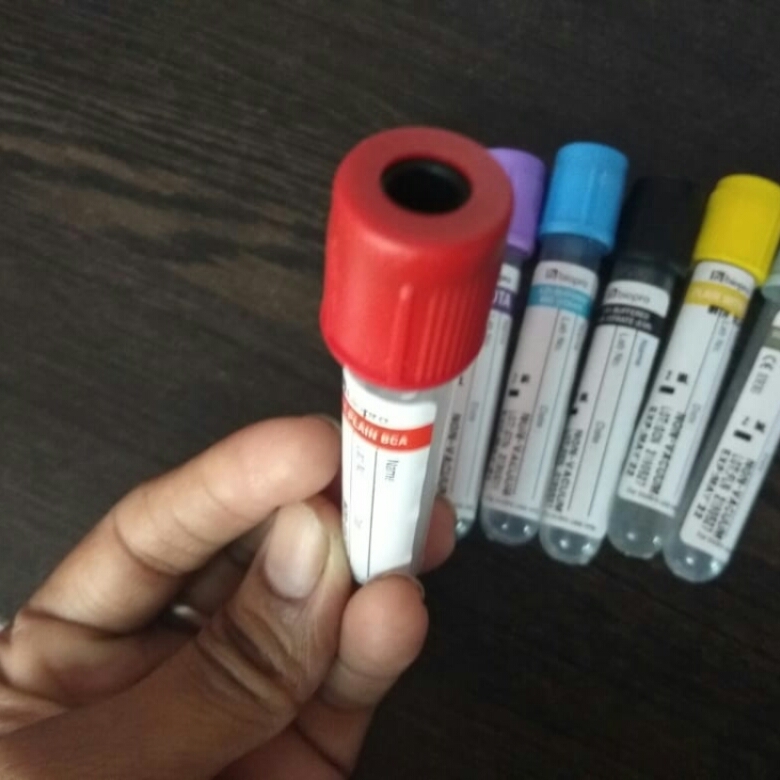 BLOOD COLLECTION TUBES VACCUM