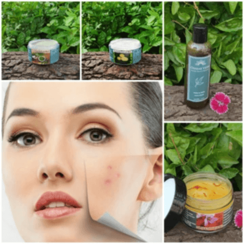 Anti - Pimples & Acne Kit (for Dry Skin)