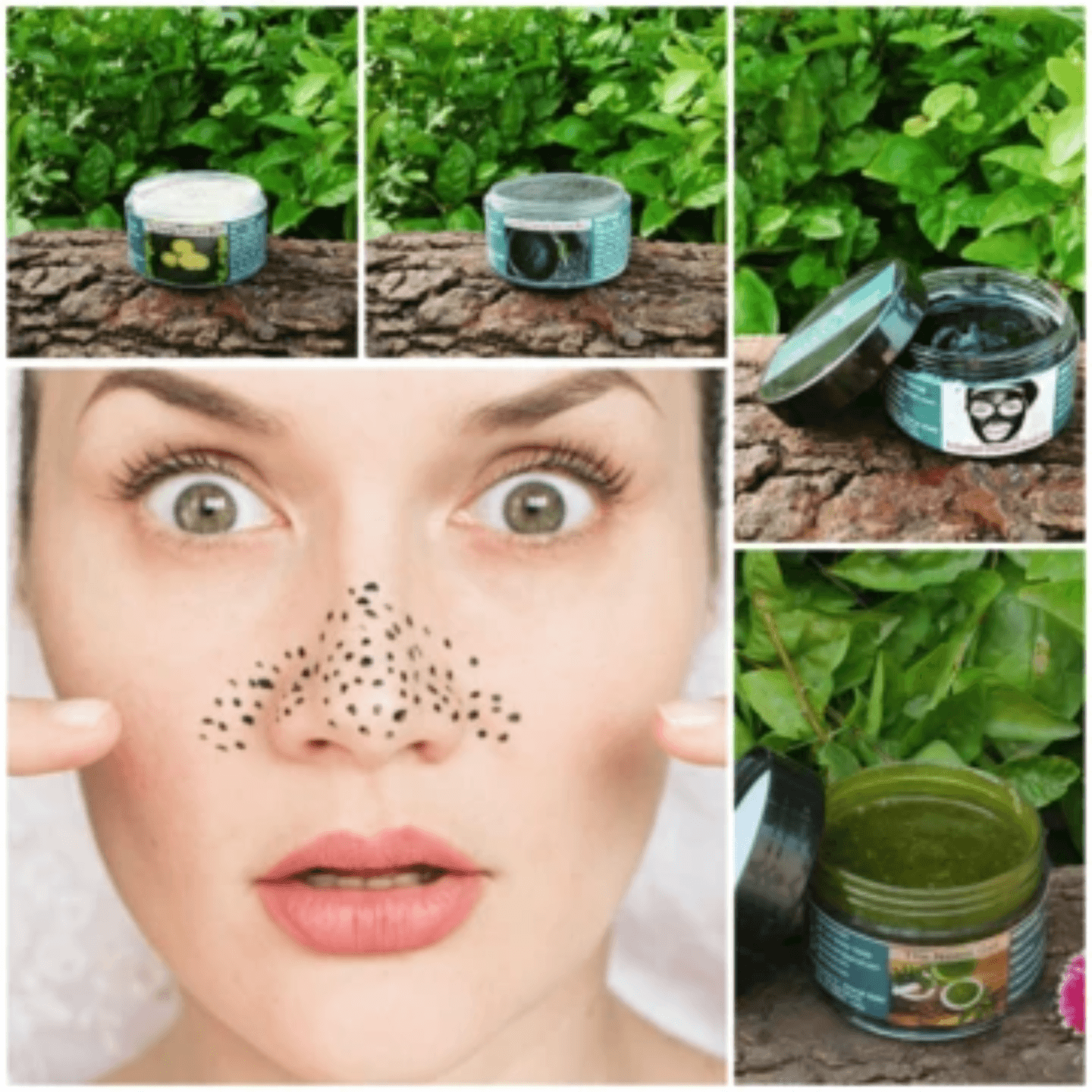 Anti-Blackhead, Whitehead Kit For Oily and Combination Skin